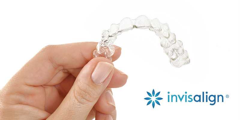 Invisalign